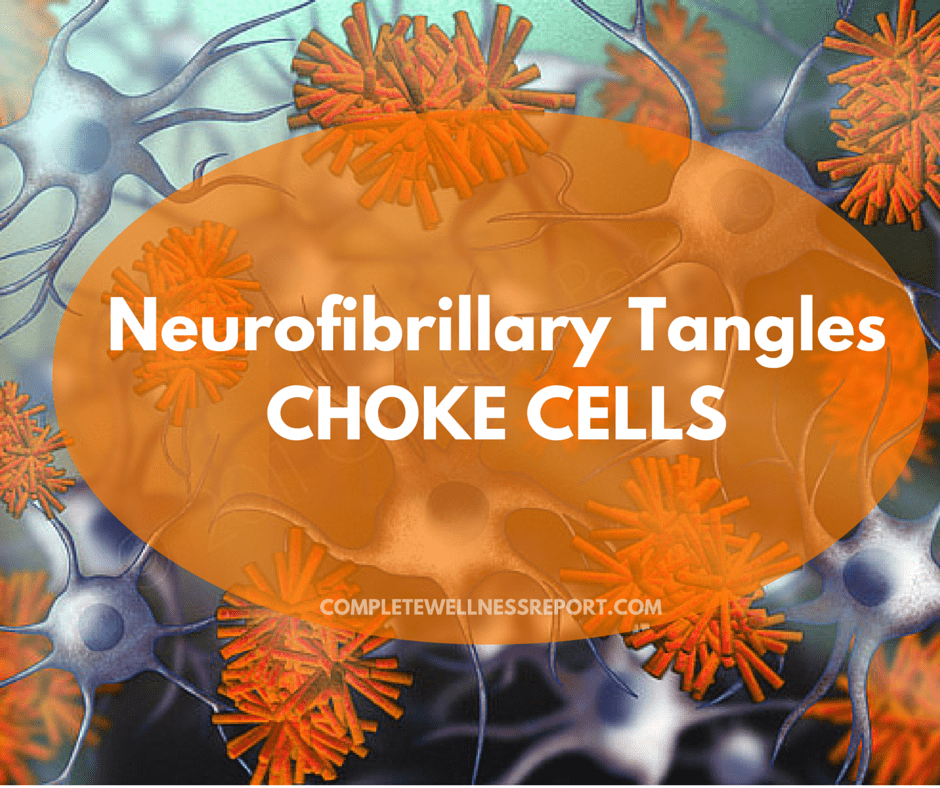 Neurofibrillary Tangles Choke Cells